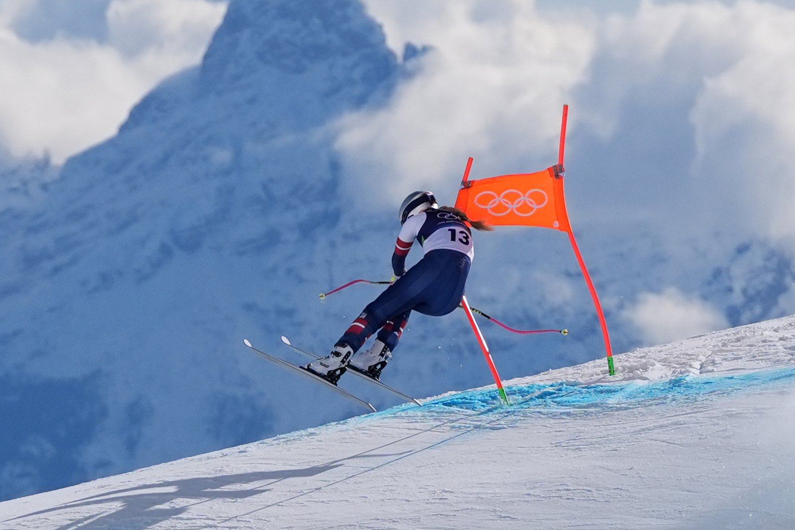 Doctor explains Lindsey Vonn's injury and her recovery process
