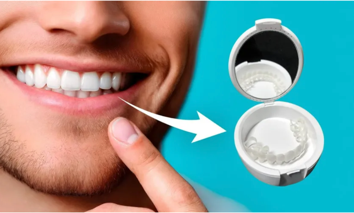 Shiny Smile Veneers 2026: Claims Examined, Pricing Verified &amp; What Consumers Should Confirm Before Buying