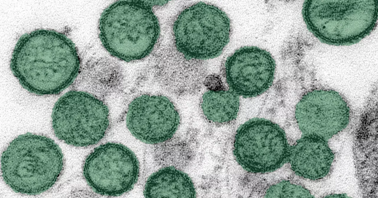 Colorado resident dies from hantavirus infection, health officials investigating