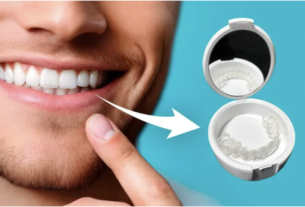 shiny smile veneers