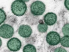colorado resident dies from hantavirus infection h colorado resident dies from hantavirus infection h 502456F1B9215479F67D5A6E26937D79
